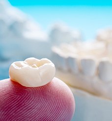 Factors that affect the cost of dental crowns include the materials used to create them