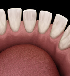 a digital illustration of a mouth with misspaced teeth